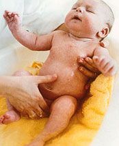 Imbaierea la nou-nascuti