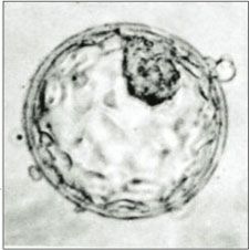 Saptamana 2 de sarcina