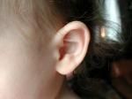 Hipoacuzia si igiena urechii